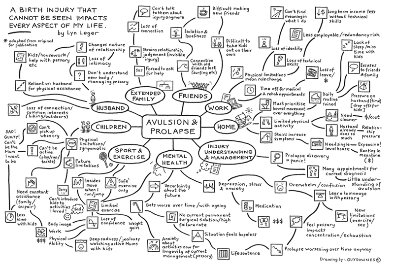 effects of levator avulsion mindmap